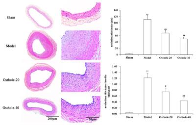 Osthole Alleviates Neointimal Hyperplasia in Balloon-Induced Arterial Wall Injury by Suppressing Vascular Smooth Muscle Cell Proliferation and Downregulating Cyclin D1/CDK4 and Cyclin E1/CDK2 Expression